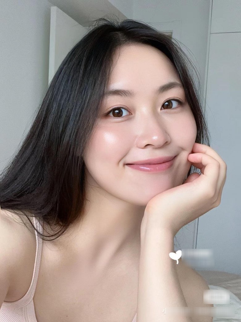 Dùng thứ nước 0 đồng dưỡng da, người trắng bật tông, người mọc mụn tràn lan vì sao? - 5