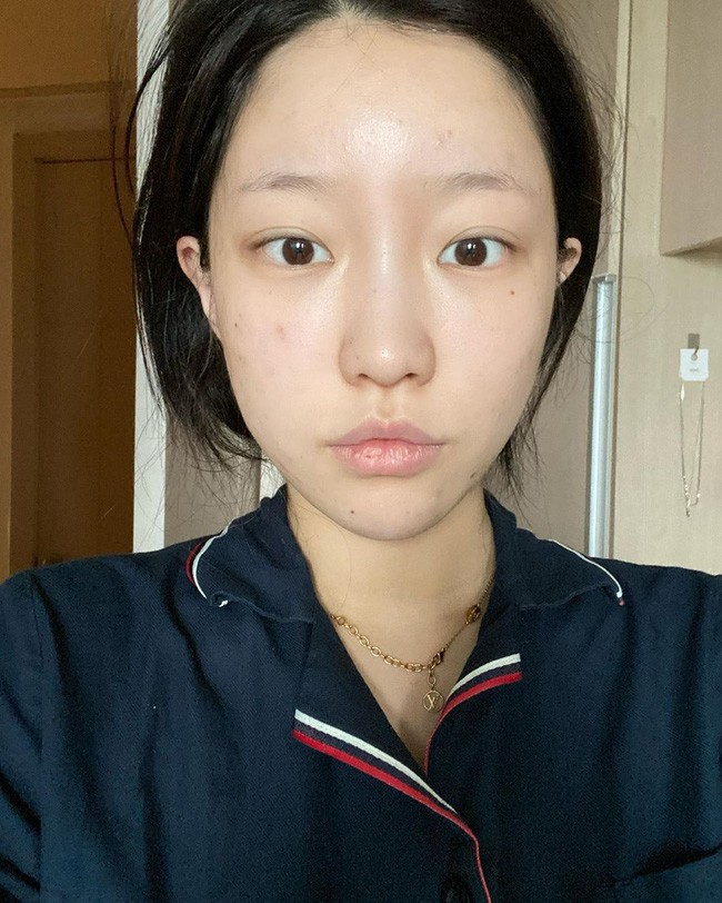 Dùng thứ nước 0 đồng dưỡng da, người trắng bật tông, người mọc mụn tràn lan vì sao? - 7